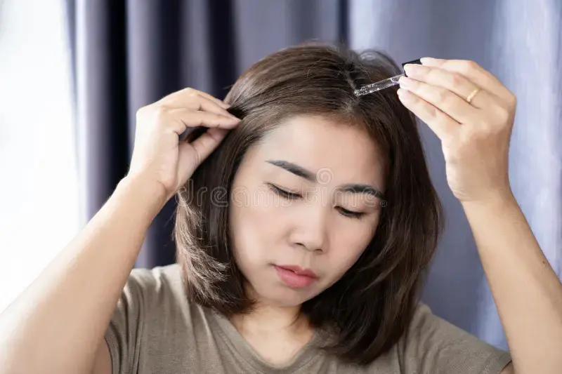 Bald Hair Solution