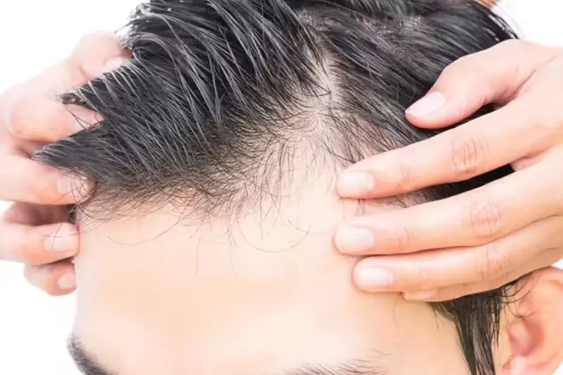How to Reduce Hair Fall for Men